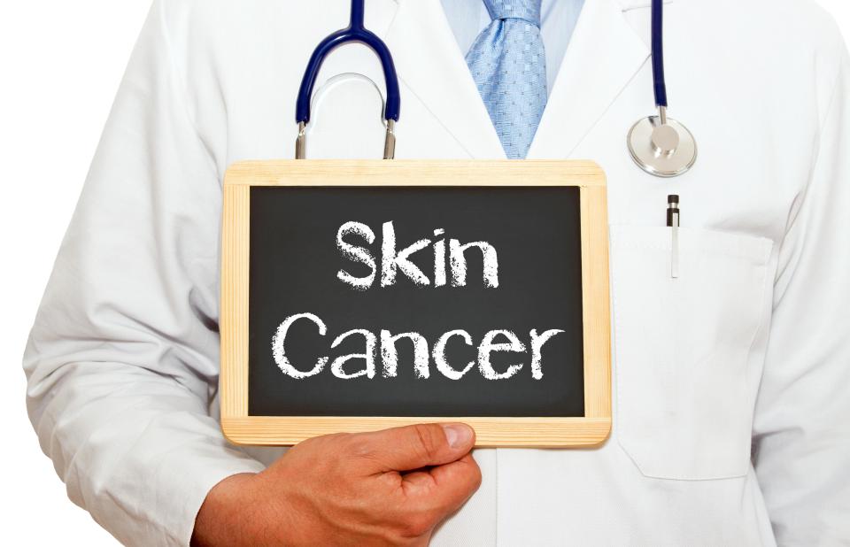most common types of skin cancer